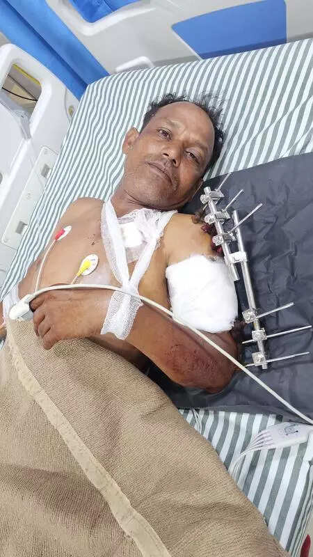 Brave resident shot while thwarting burglary attempt