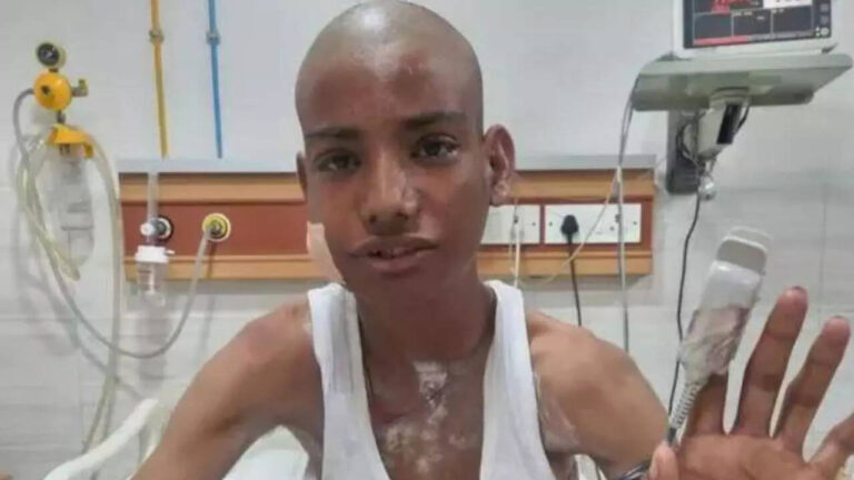 ‘1mm off, he could have died’: Kota teen shot while playing, bullet travels through skull; lodged in cheek for 5 days